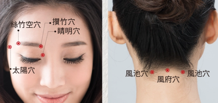 中醫頭痛治療 中醫頭痛治療